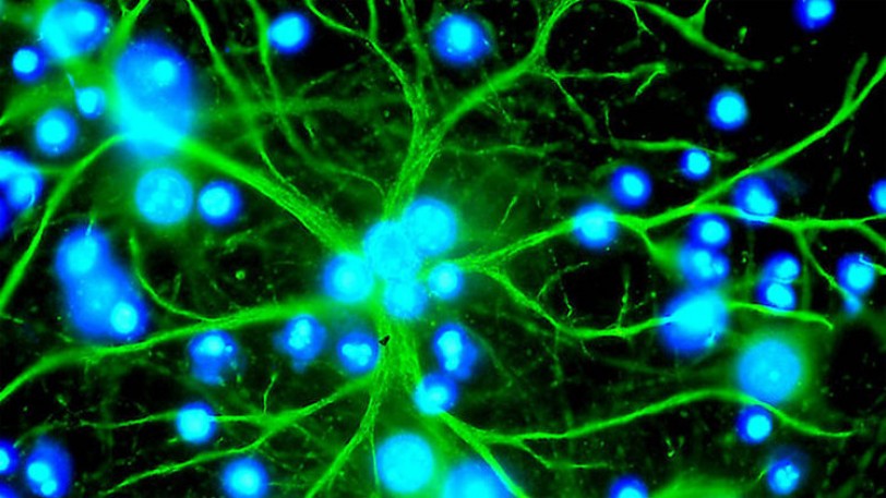 دراسة: توليد خلايا عصبية من خلايا مساعدة