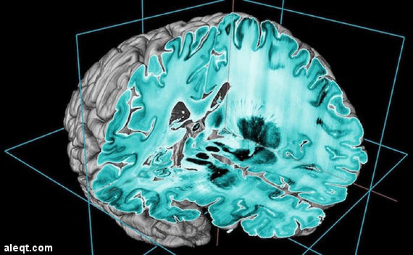 صورة ثلاثية الأبعاد تفتح آفاقاً غير مسبوقة لفهم وظائف المخ