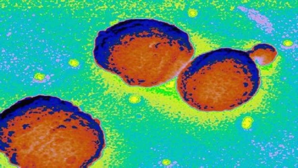 علماء يحذرون من بكتيريا ثلاثية الأخطار!