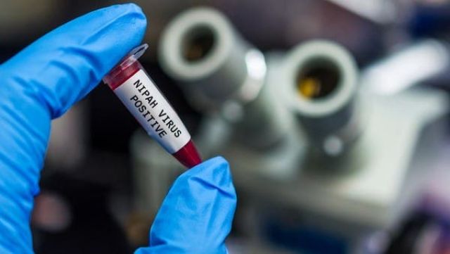 فيروس «نيباه» بعيداً عن تضليل «الغارديان» ماذا يقول الطب المُسنَد بالبيِّنات؟