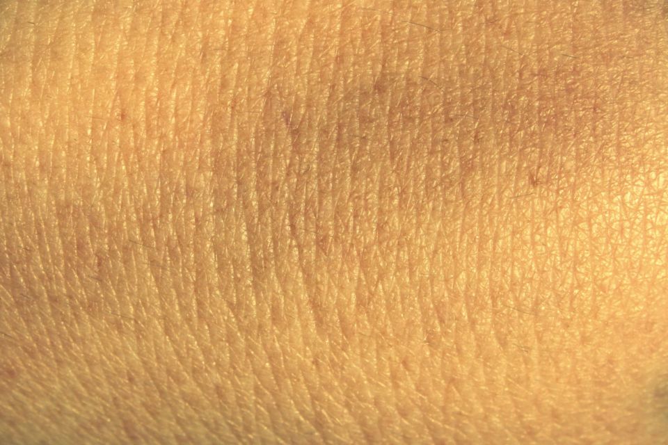 الحالة النفسية وأثرها في الجلد