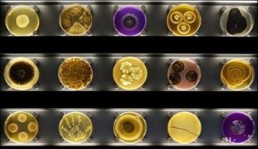 فيروس مركب يسرّع انتقال الدواء في جسم المريض