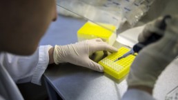 ابتكار مصل ضد حمى ايبولا في روسيا