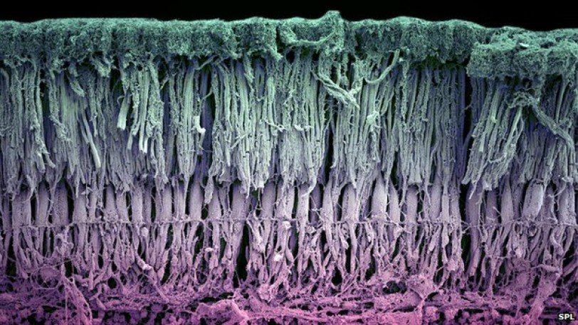 باحثون: خلايا أعين الموتى قد تعيد الإبصار للأحياء