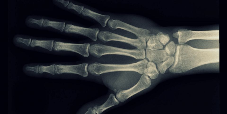 هل انتهى زمن التصوير الشعاعي؟