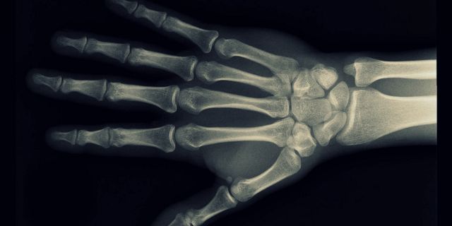 هل انتهى زمن التصوير الشعاعي؟