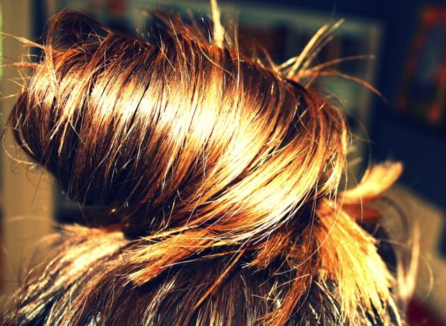 قد تعاني بعض النساء من ثعلبة تالية للولادة، وهي أحد أنواع تساقط الشعر الكربي التي يسببها التغير المفاجئ في مستويات الهرمونات