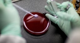 اكتشاف الأورام بالليزر!