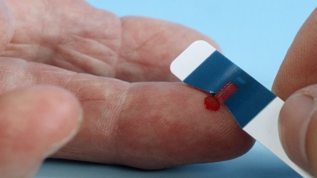 أسباب أمراض الكبد المميتة