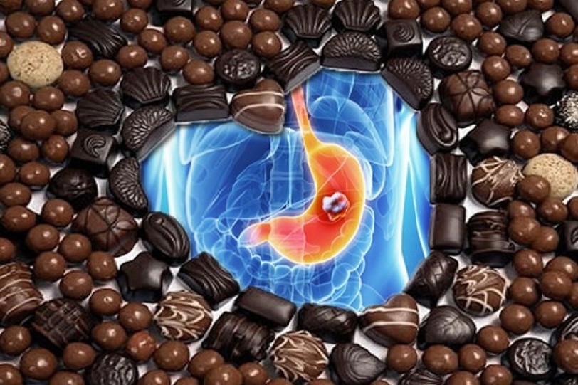 الشوكولاتة تتسبب في الإصابة بسرطان الأمعاء