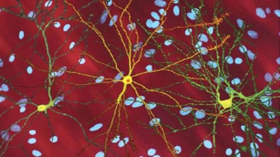 وسيلة مضادة لأمراض الدماغ المميتة