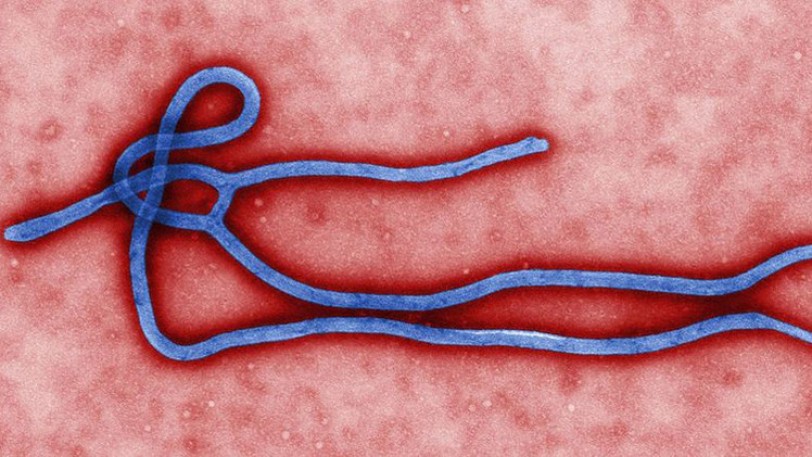 خمسة فيروسات أكثر خطورة من إيبولا