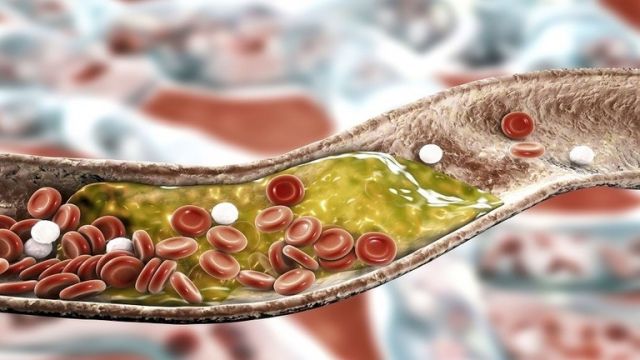 خطر «انخفاض» الكوليسترول
