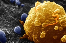 الغرافين مادة لعلاج السرطان