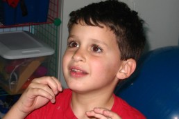 شذوذ في مركز الكلام بالدماغ يسبب التأتأة