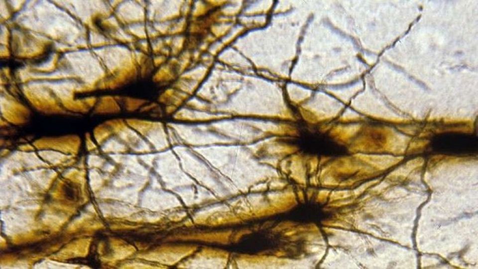 تطوير ذكاء صناعي بقدرات غير مسبوقة