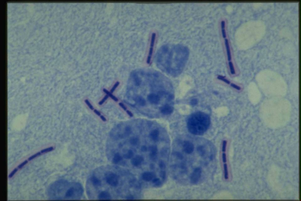 دراسة تفكيك بعض المضادات الحيوية في المياه العادمة  باستخدام تقانة الأكسدة الضوئية الحفزية