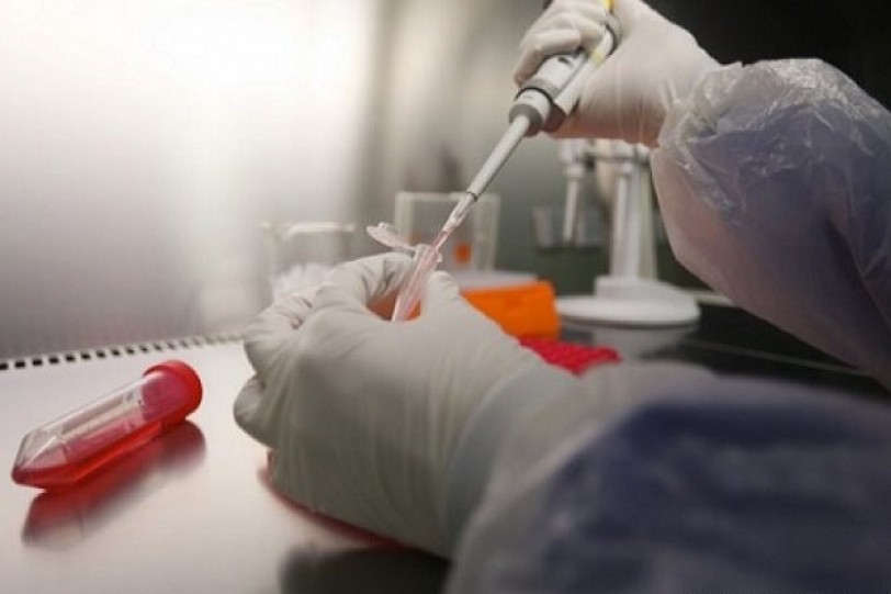 كورونا يحصد أرواح 29 ويصيب 180 في كوريا الجنوبية