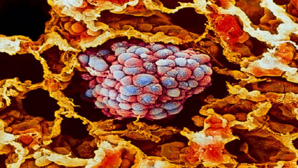 طريقة جديدة لتحفيز المناعة لتدمير السرطان