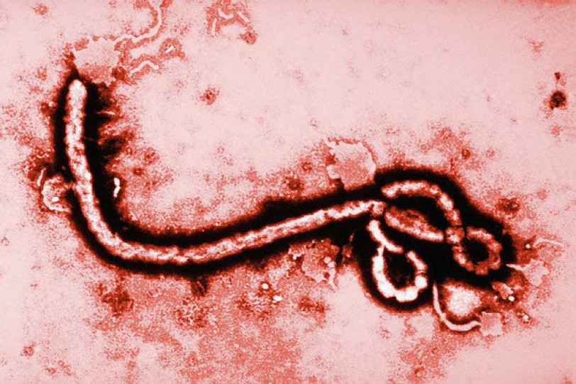 العلماء يكتشفون 345 طفرة لفيروس «ايبولا»