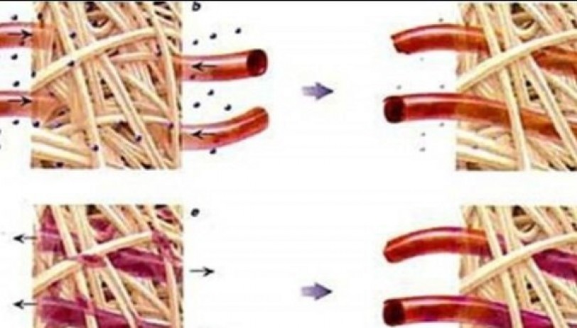 إيران تنجح في ترميم أنسجة القلب عبر اختراع جديد