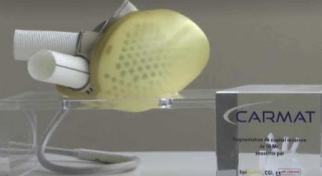 شركة فرنسية تبيع أول قلب اصطناعي من إنتاجها