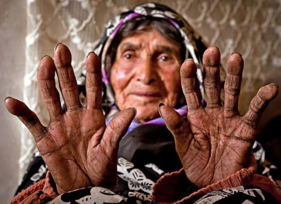 يوم المرأة الأُمَميّ وحقوق المرأة (مقارنات)