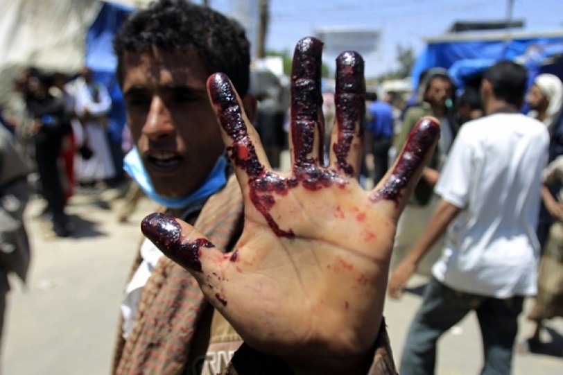 767 قتيلا حصيلة النزاع في اليمن