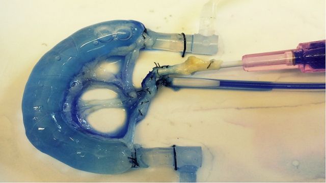 يمكن استخدام هذه الطريقة عند البشر الذين يعانون من مشاكل في الجهاز الهضمي