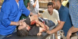 20 شهيداً و40 مصاباً في اعتداءات إرهابية على حلب