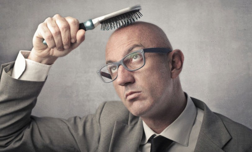 دراسة حول العلاقة بين الجاذبية الأرضية والصلع