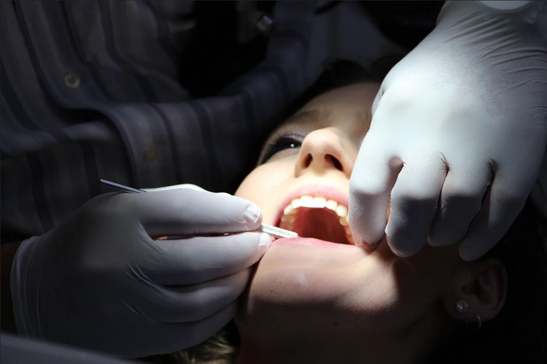 طب الأسنان بين أسعار النقابة وأسعار العيادات