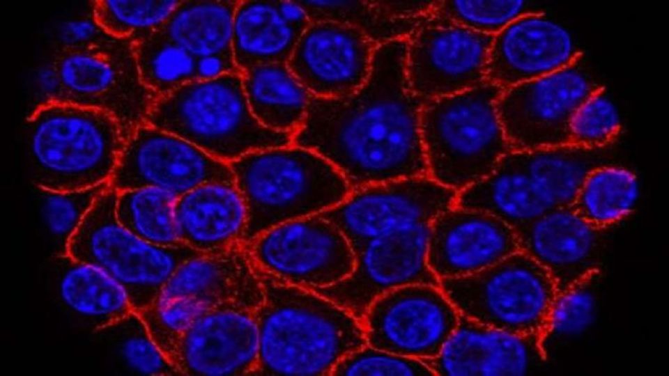 علامة مميزة لظهور السرطان