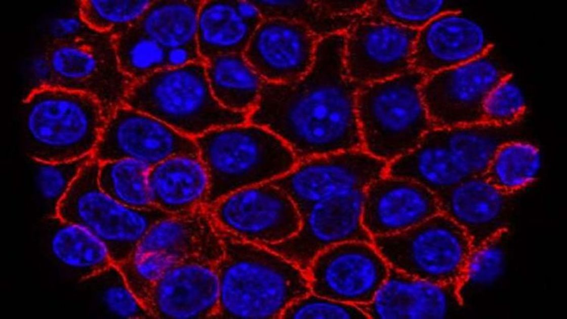 علامة مميزة لظهور السرطان