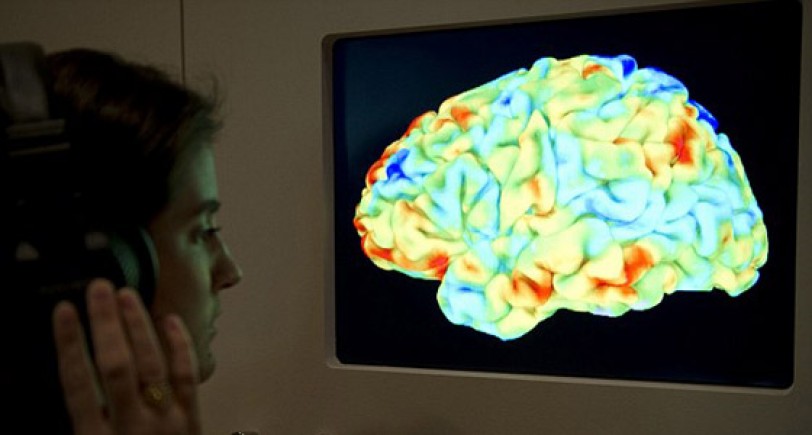 تقرير: منطقة في الدماغ لا تشيخ مع تقدم الانسان في العمر