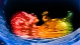 بريطانيا تشرع تقنية &laquo;الإخصاب الثلاثي&raquo;